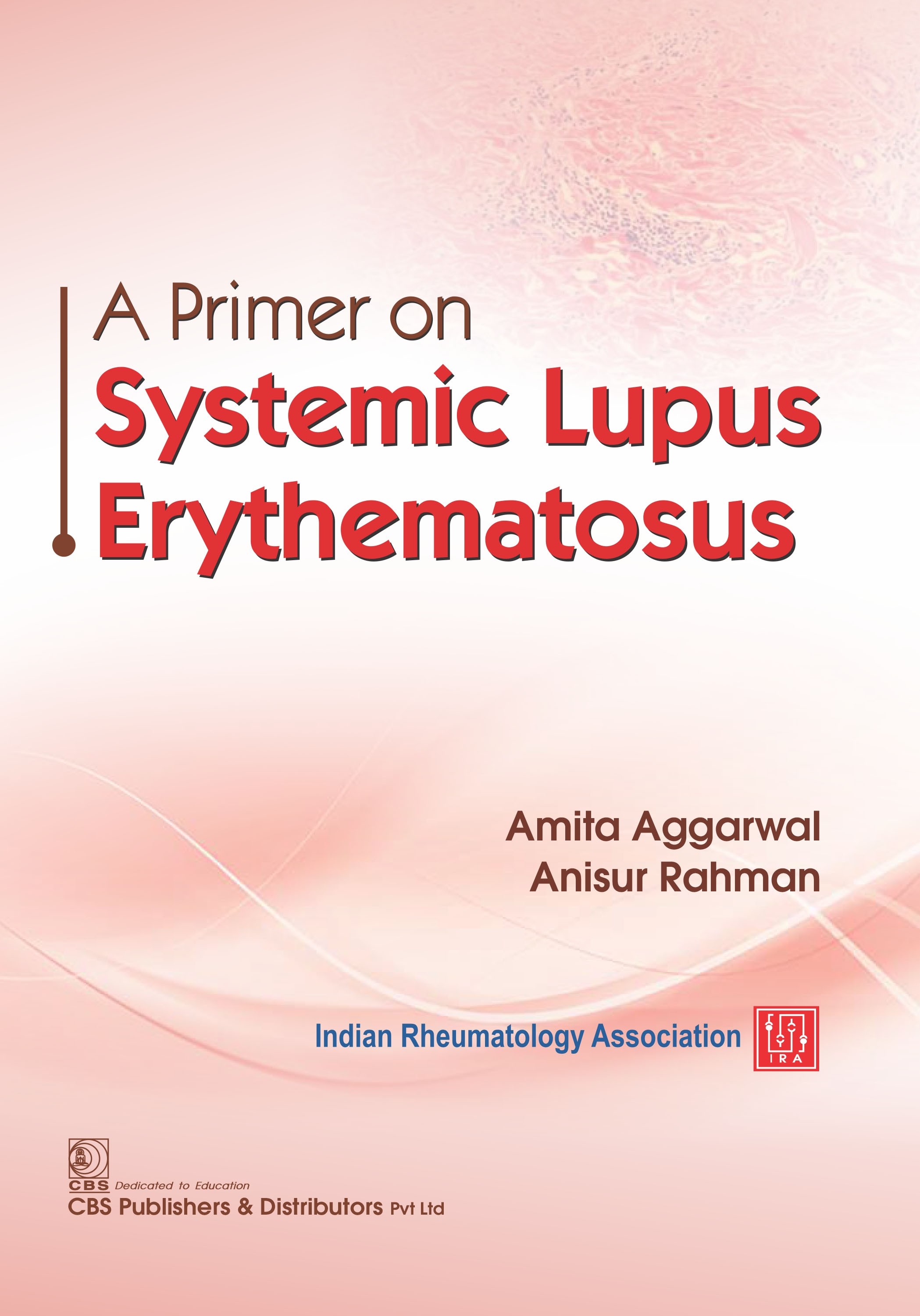 A primer on systemic lupus  erythematosus