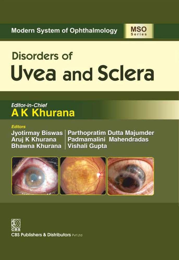 Modern system of ophthalmology (mso series): disorders of uvea and sclera 