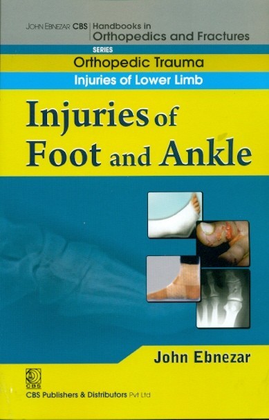 Injuries of foot and ankle (handbook in orthopedics and fractures series, vol. 18 - orthopedic trauma injuries of lower limb)