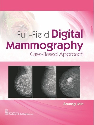 Full-field digital mammography case-based approach