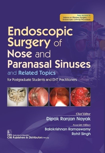 Endoscopic surgery of nose and paranasal sinuses and related topics for postgraduate students and ent practitioners