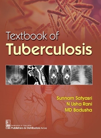 Textbook of tuberculosis