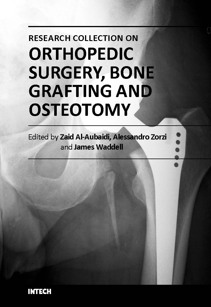 Orthopedic surgery bone grafting and osteotomy (hb 2016) 