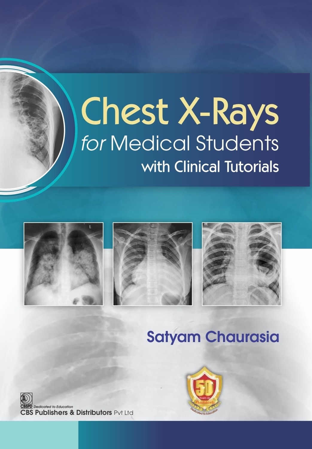 Chest x-rays for medical students with clinical tutorials