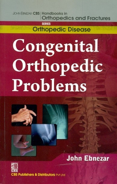 Congenital orthopedic problems (handbooks in orthopedics and fractures series, vol.28: orthopedic disease)a)