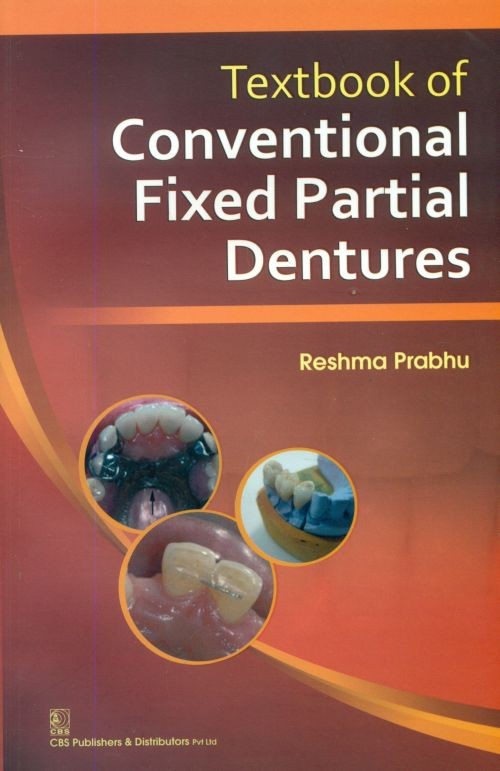Textbook of conventional fixed partial dentures (pb-2014)