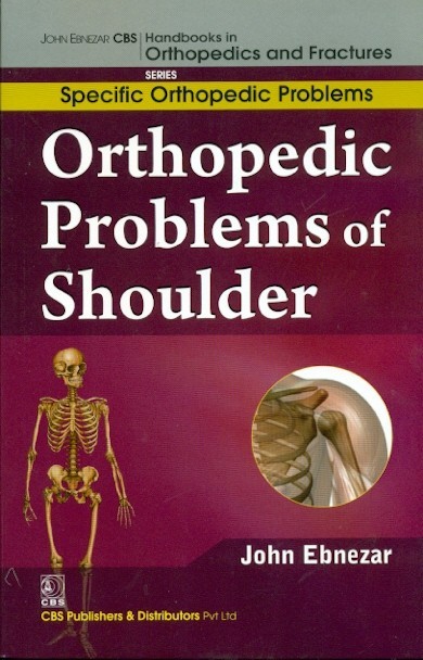 Orthopedic problems of shoulder (handbooks in orthopedics and fractures series, vol.43: specific orthpedic problems)