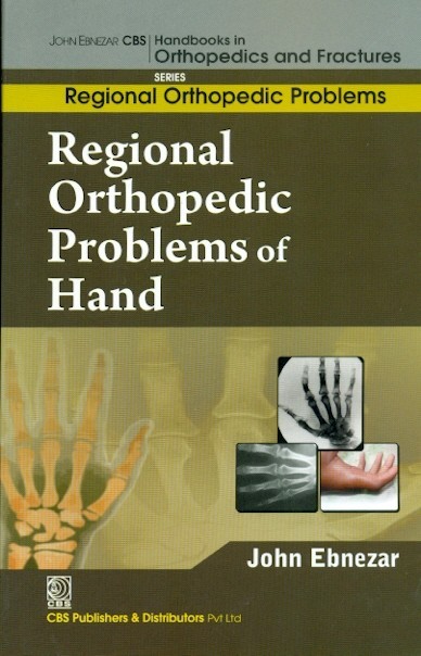 Regional orthopedic problems of hand (handbooks in orthopedics and fractures series, vol. 51: regional orthopedic problems )