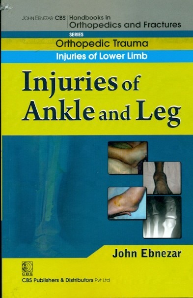 Injuries of ankle and leg (handbook of orthopedics and fratures series, vol. 17: orthopedic trauma injuries of lower limb)