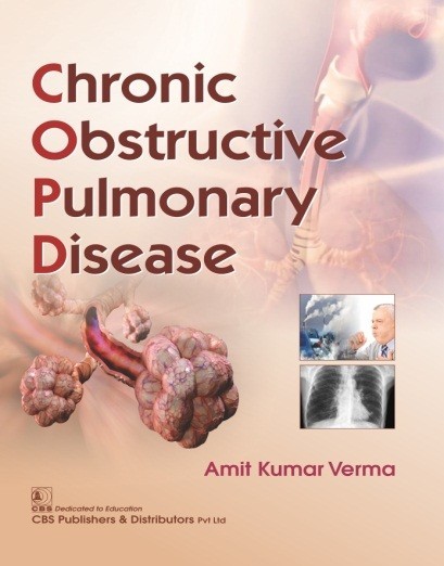 Chronic obstructive pulmonary disease