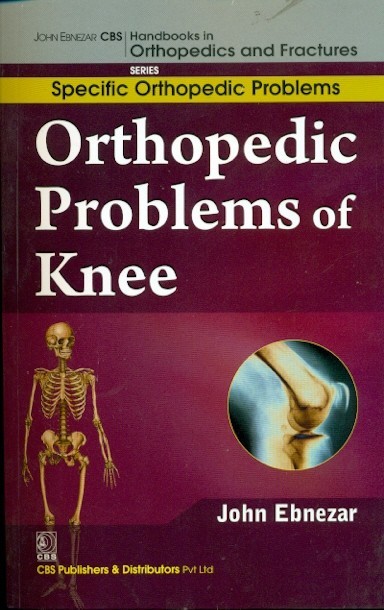 Orthopedic problems of knee (handbooks in orthopedics and fractures series, vol. 41: specific orthopedic problems)