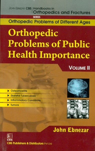 Orthopedic problems of public health importance-11 (handbooks in orthopedics and fractures series, vol. 83- orthopedic problems of different ages)
