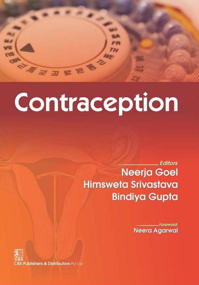 Contraception 