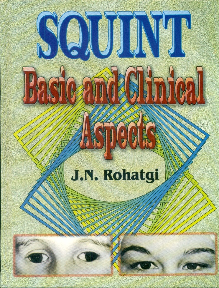 Squint basic and clinical aspects