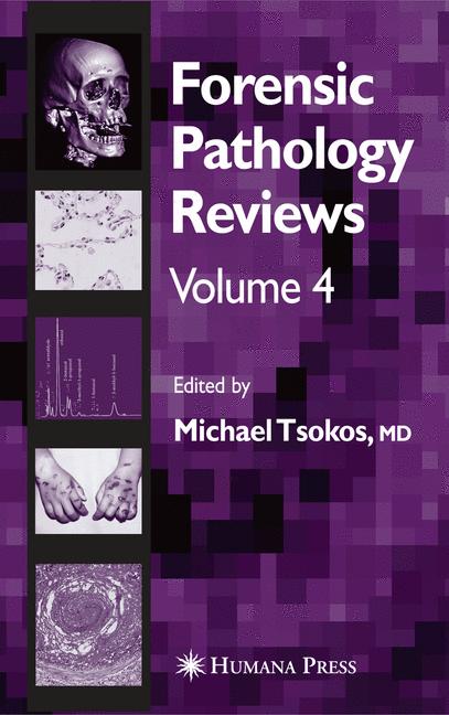Forensic pathology reviews vol 4 