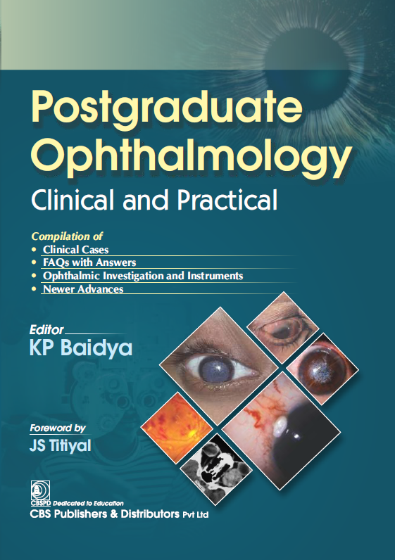 Postgraduate ophthalmology clinical and practical